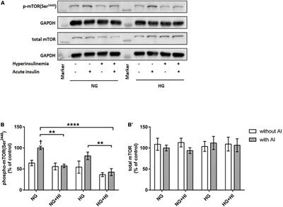 Interactive contribution of hyperinsulinemia, hyperglycemia, and mammalian target of rapamycin signaling to valvular interstitial cell differentiation and matrix remodeling